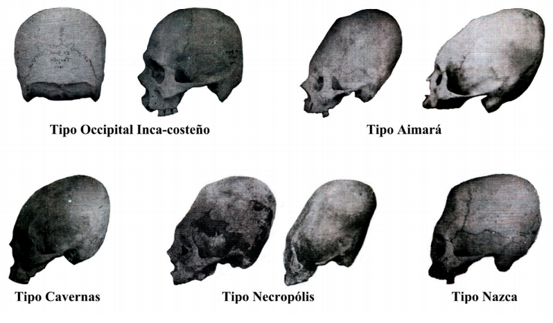 Deformación craneal precolombina